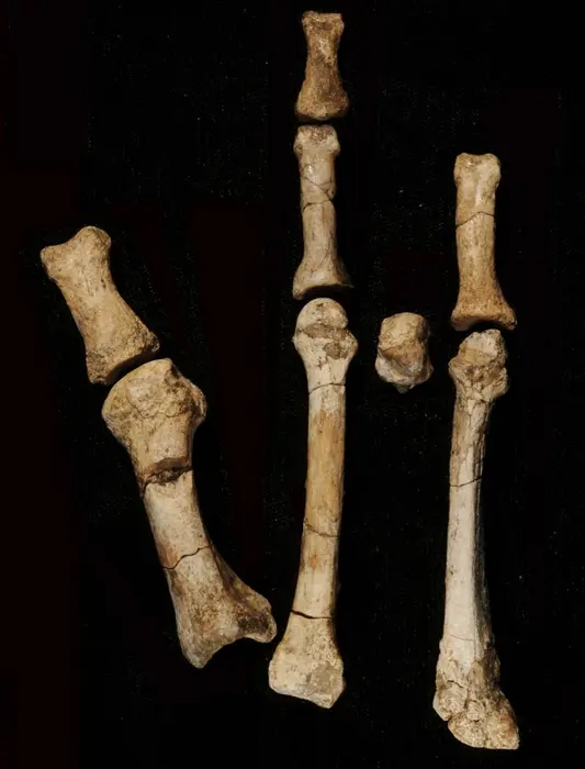 اجزای پای برتلِ